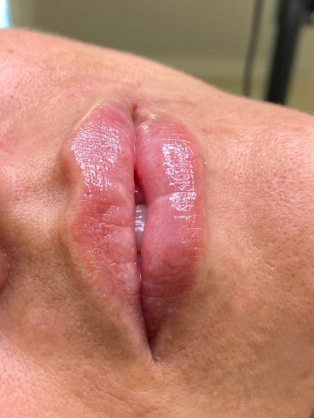 Pelu Studio Perfect Lips Hidralips Hydra gloss lips